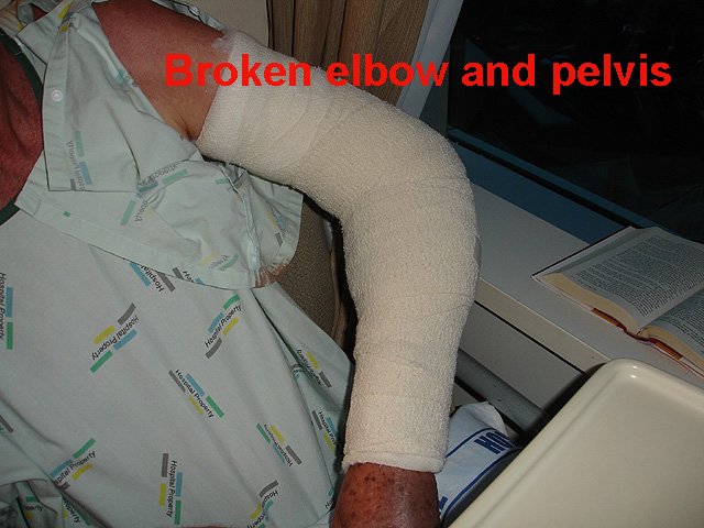 elbow.JPG (128156 bytes)